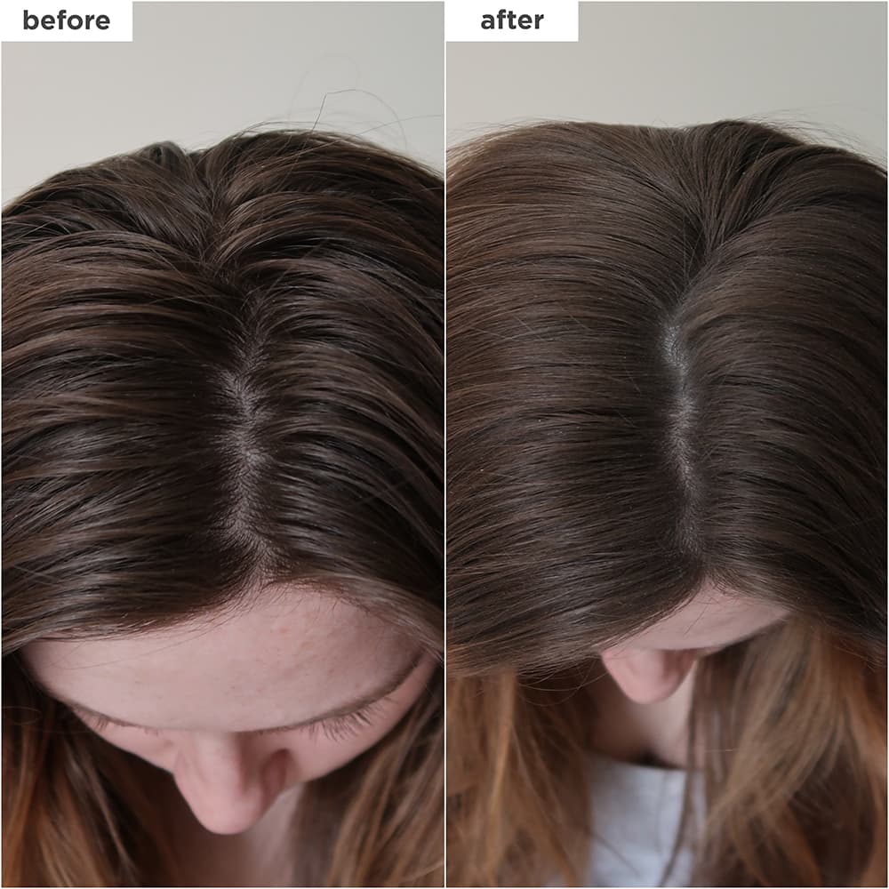 Briogeo Scalp Revival Charcoal + Biotin Dry Schampo 50 ml 2