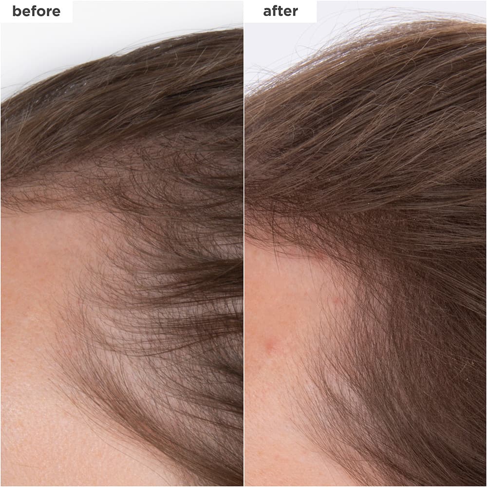 Briogeo Destined for Density MegaStrength+ Caffeine + Biotin Peptide Density Serum 45 ml 2