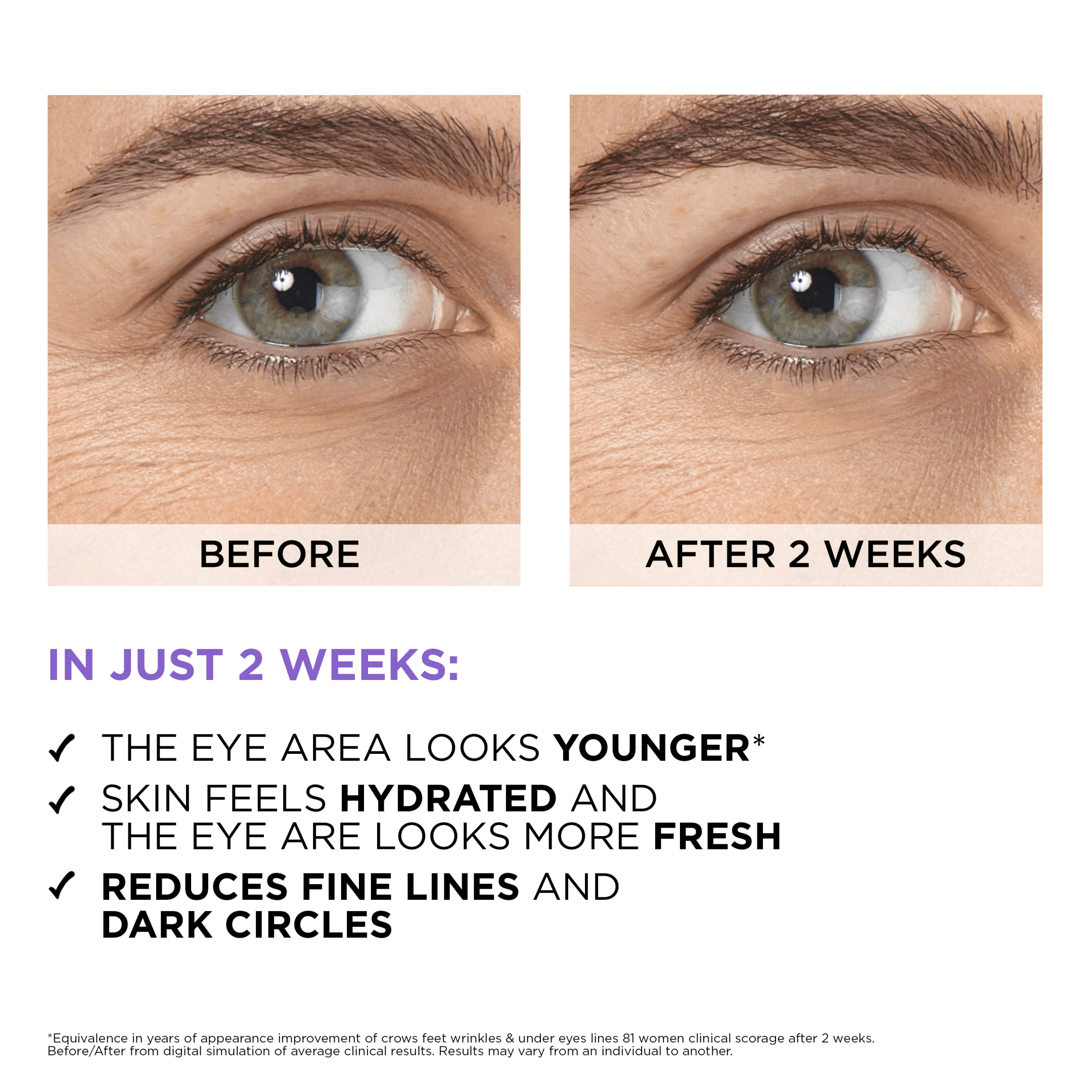L'Oréal Paris Revitalift Filler 2.5% Hyaluronic Acid+Caffeine Eye Serum 20ml - produktbild 4