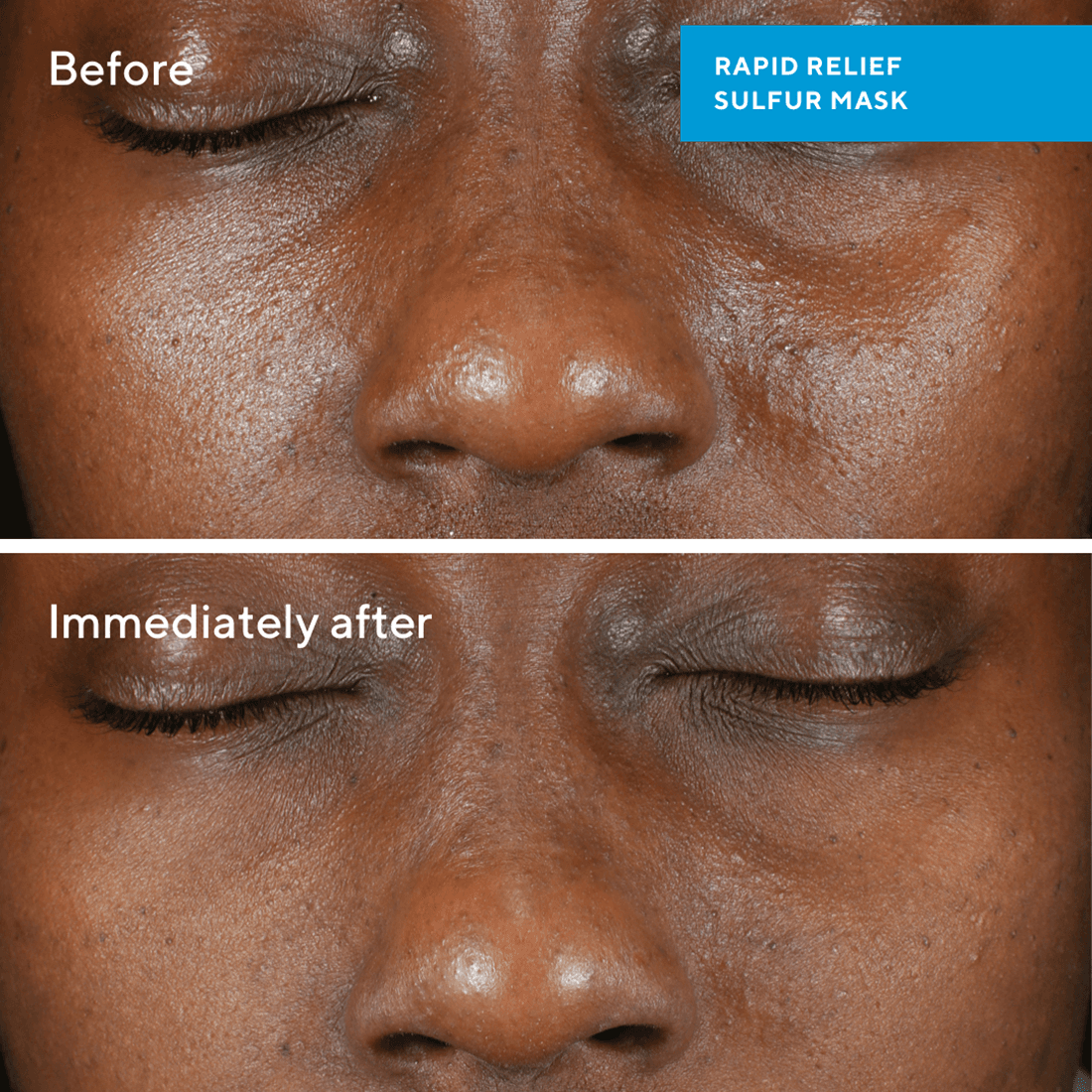 Murad Rapid Relief Sulfur Mask 75 ml - produktbild 2