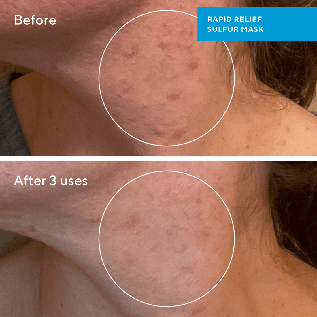 Murad Rapid Relief Sulfur Mask 75 ml - produktbild 4