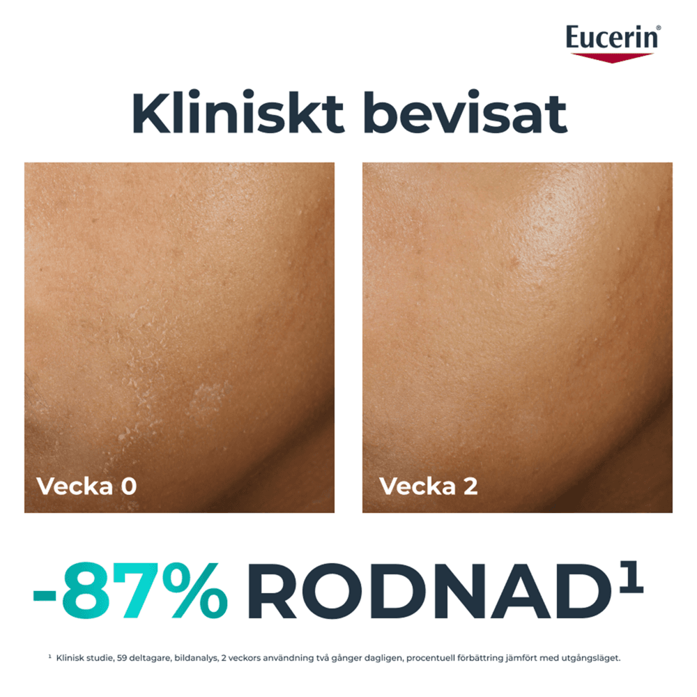 Eucerin DermoPure Hydra Repair 40 ml - produktbild 2