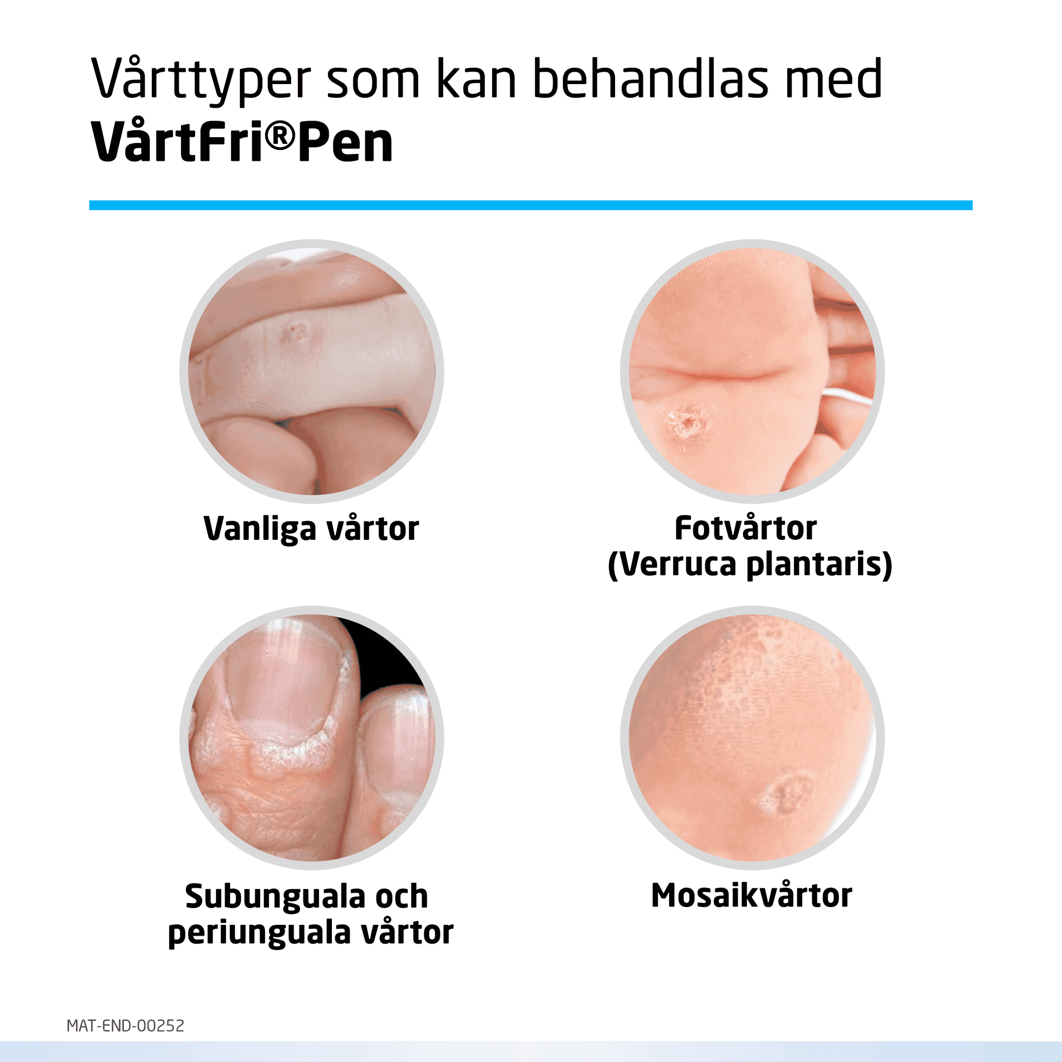 Vårtfri Pen 30 st 3