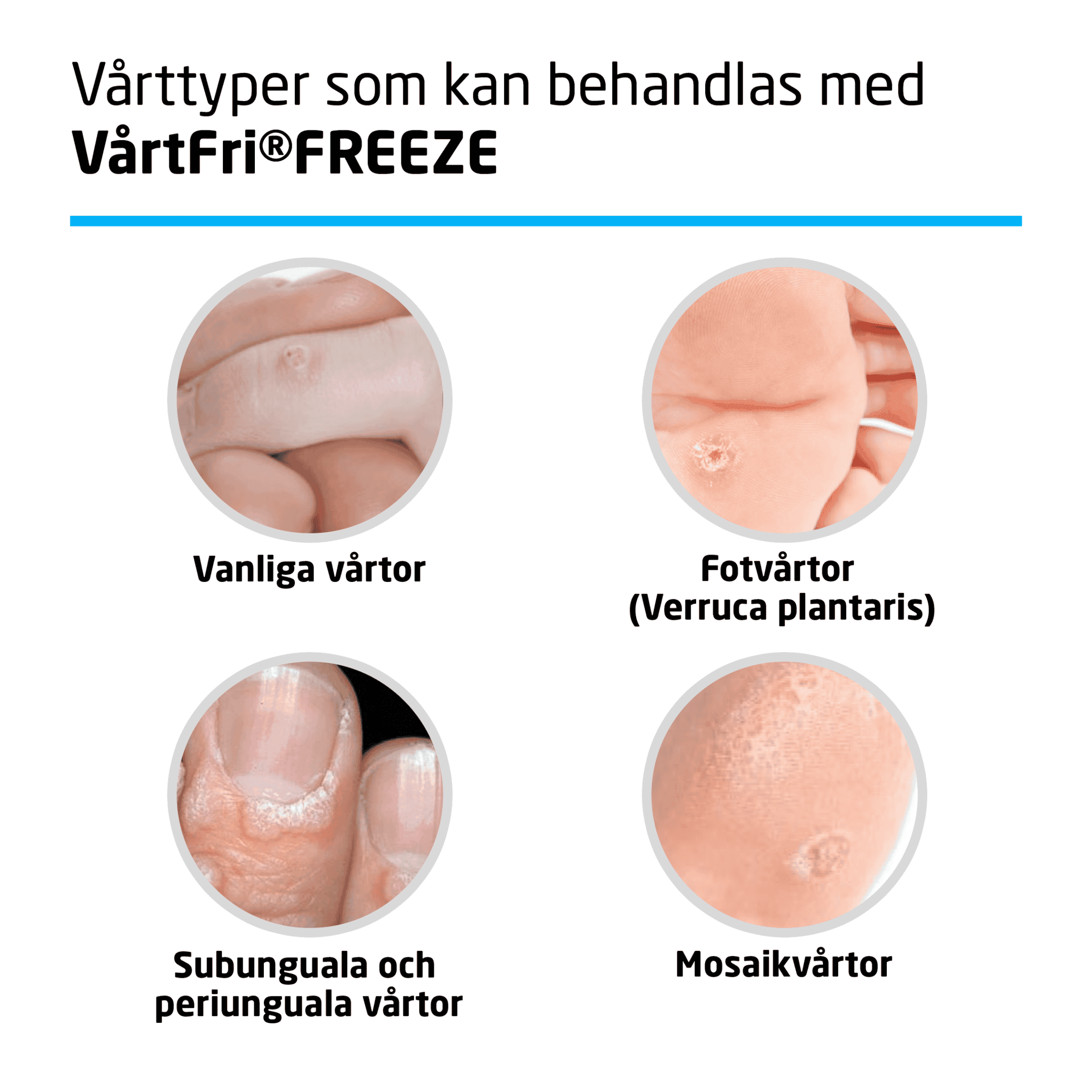 Vårtfri Freeze 21 ml 3