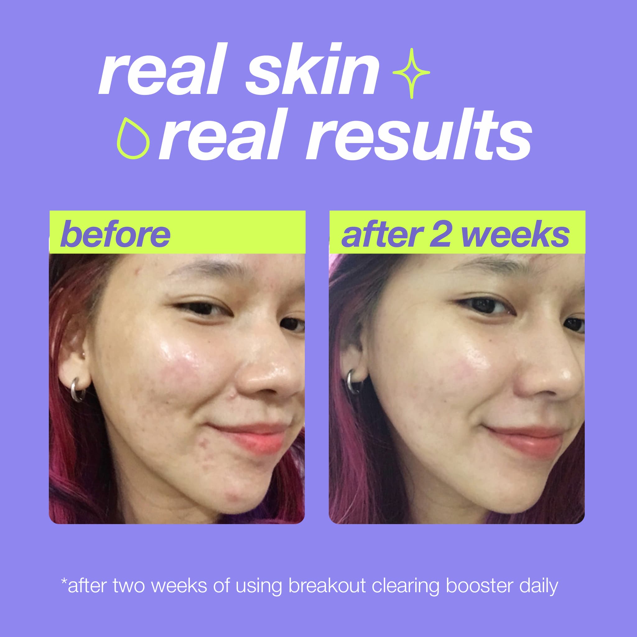 Dermalogica Breakout Clearing Booster 30 ml 3