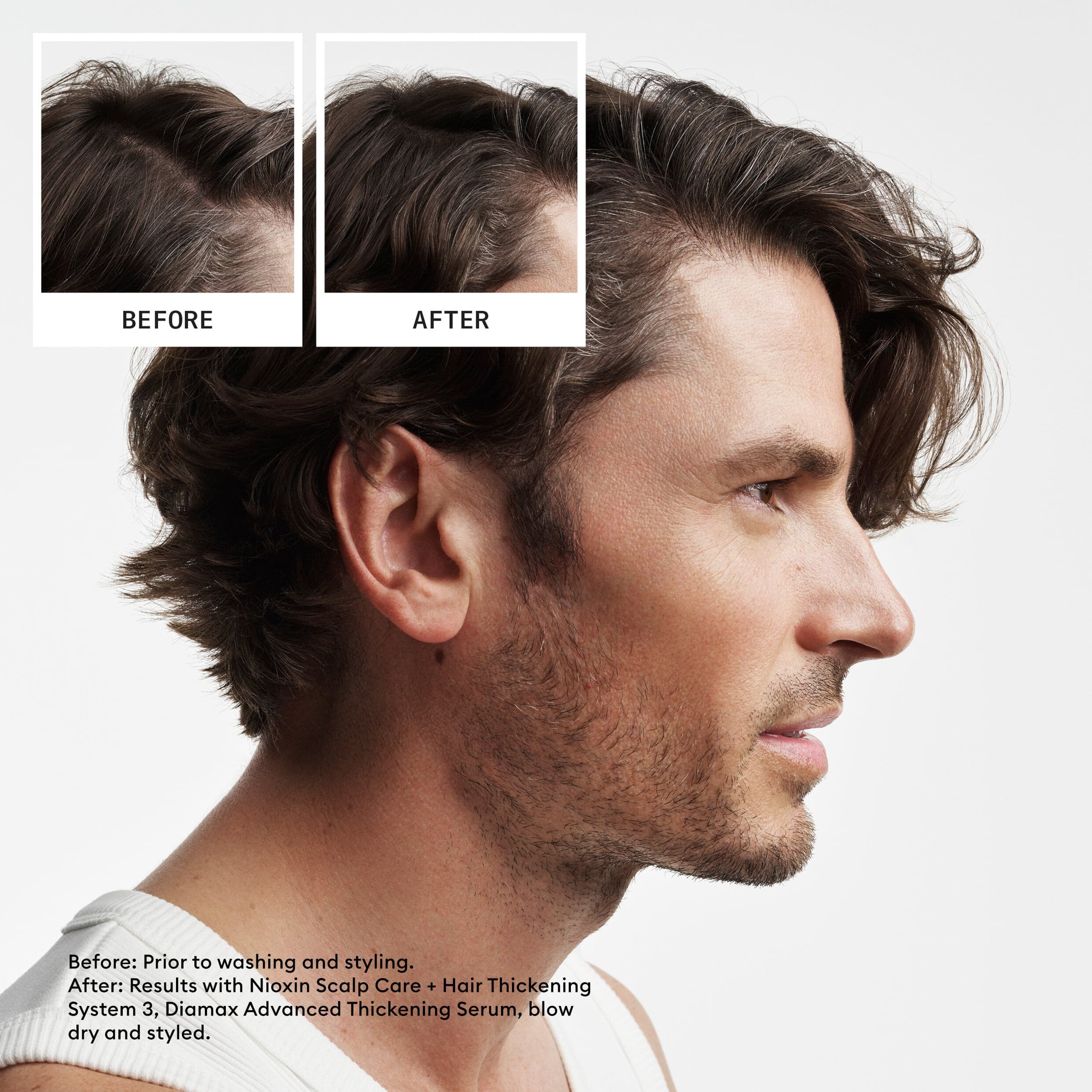 Nioxin System 2 Loyalty Kit 2