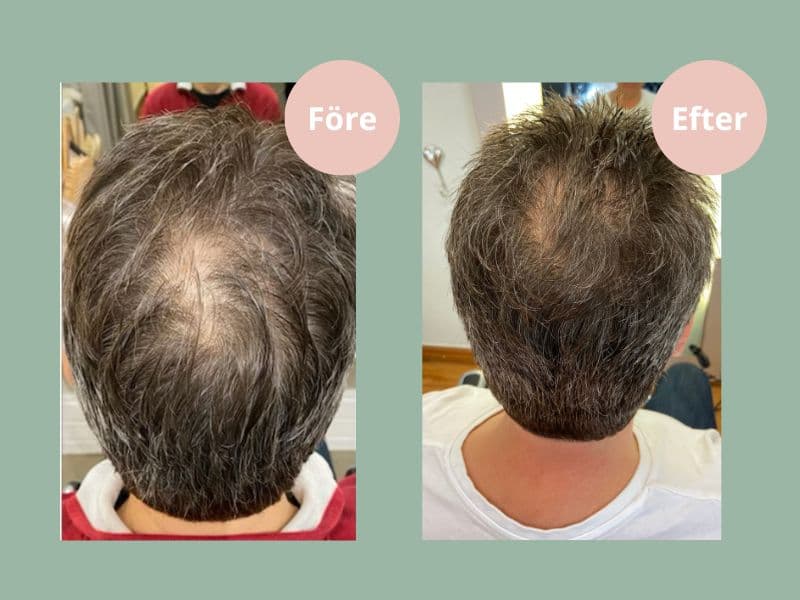 Hjärtligt Hair Growth Balsam 250 ml 2