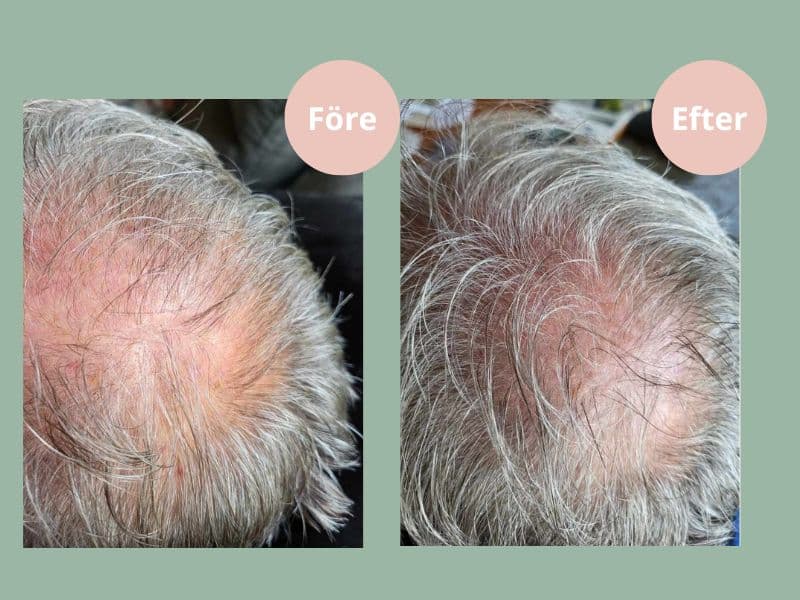 Hjärtligt Hair Growth Balsam 250 ml 3