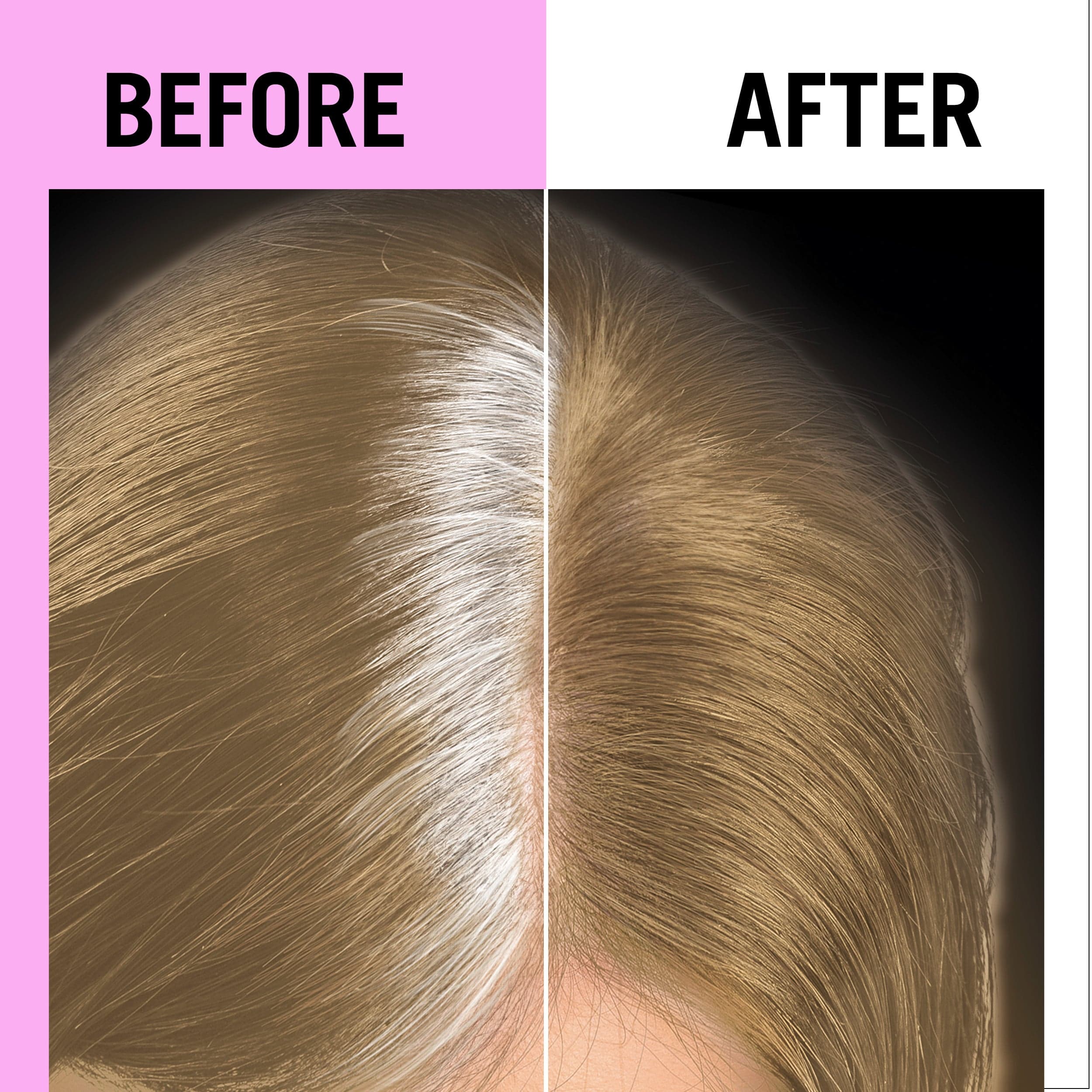 Schwarzkopf Root Retouch Permanent Color BR1 Medium Blonde - produktbild 4
