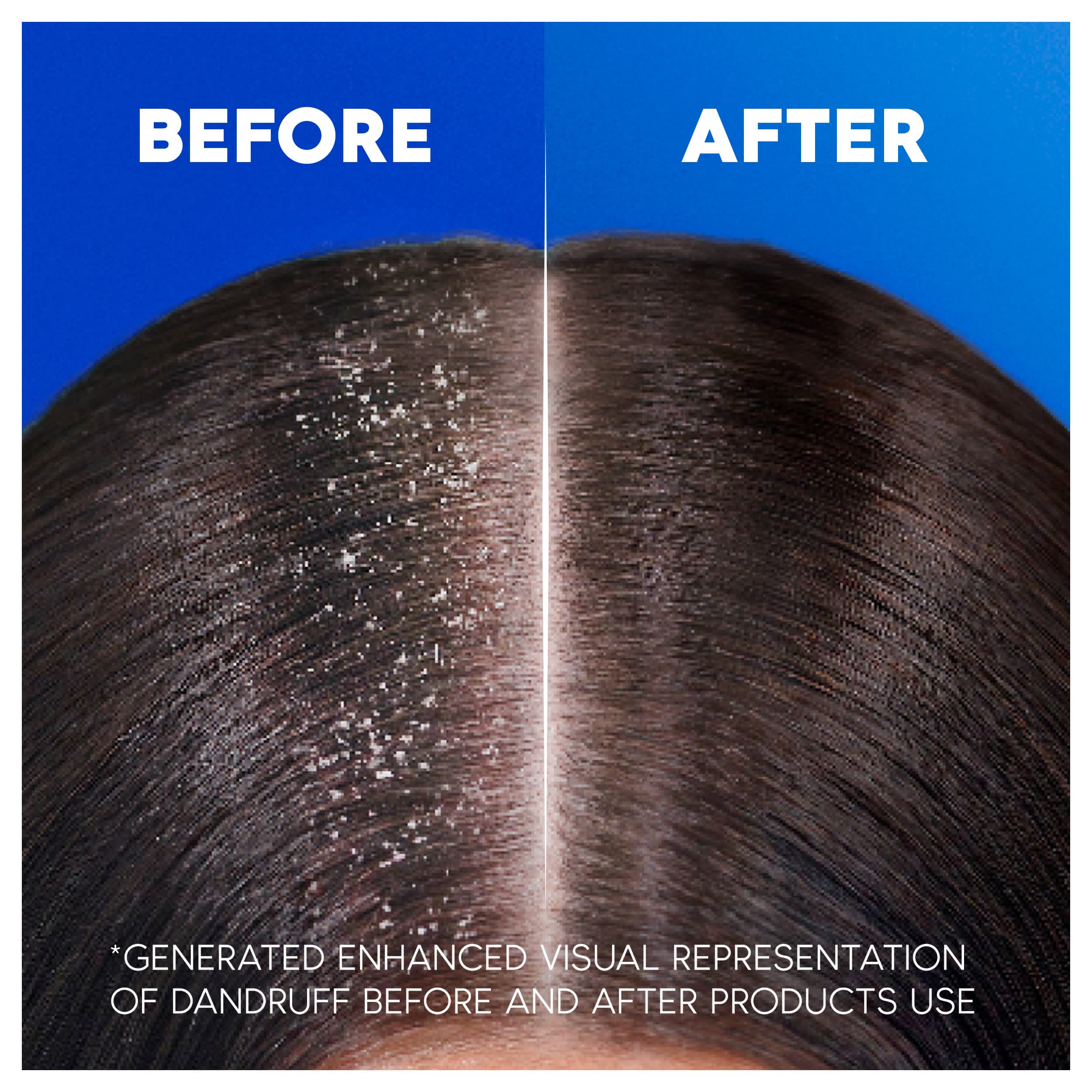 Head & Shoulders Citrus Fresh Mjällschampo för fett hår 1000 ml 3
