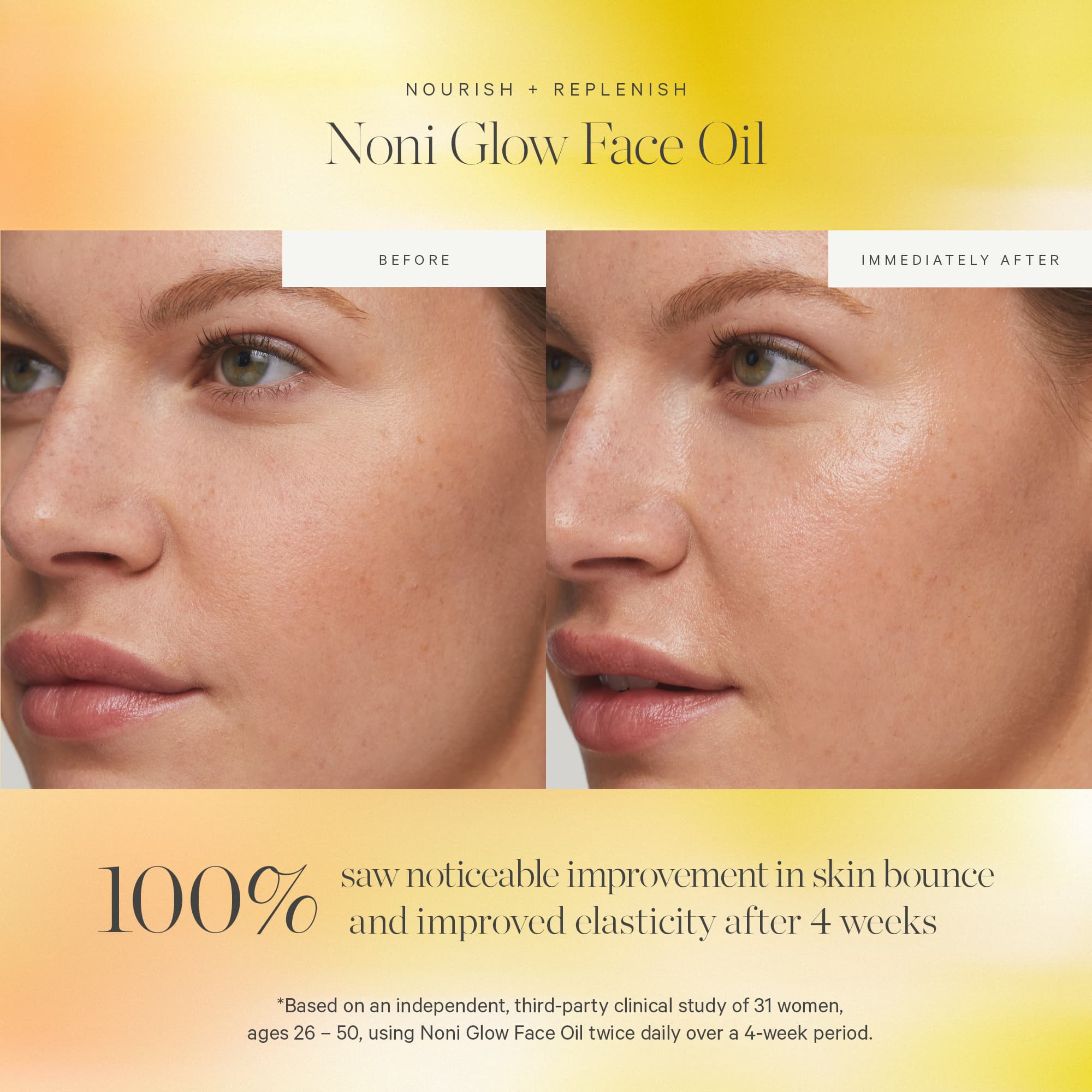 KORA Organics Noni Glow Face Oil 10 ml 4