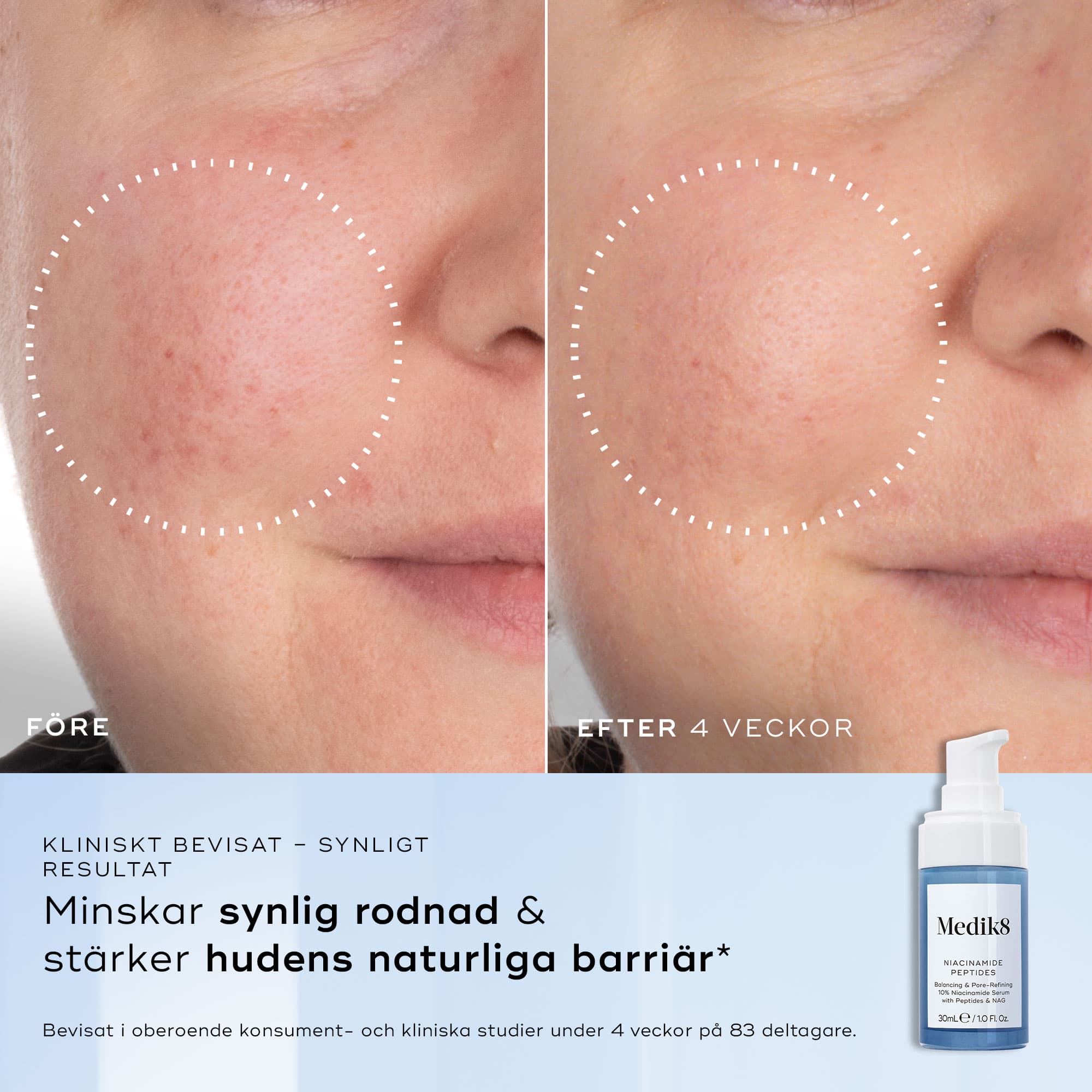 Medik8 Niacinamide Peptides 30 ml - produktbild 4