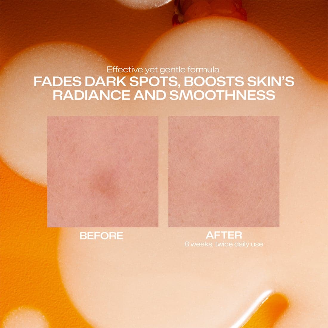 Lumene Dark Spot Serum 30 ml - produktbild 2