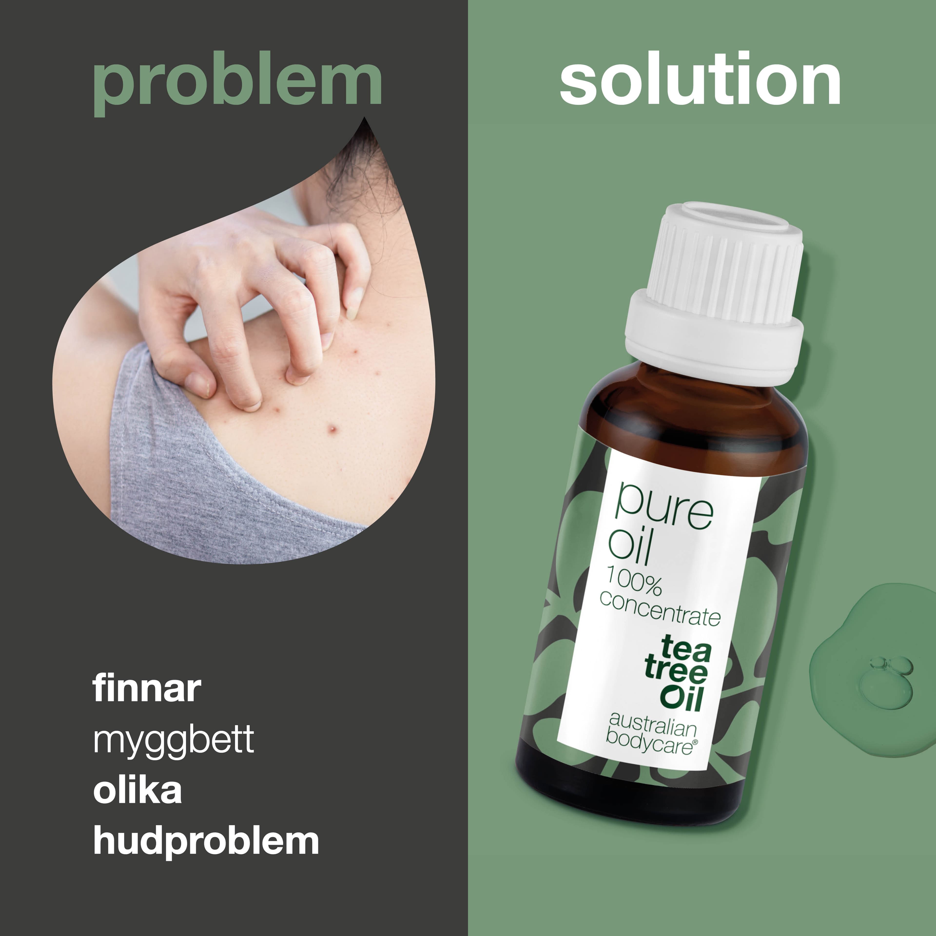 Australian Bodycare Pure Oil 30 ml 2