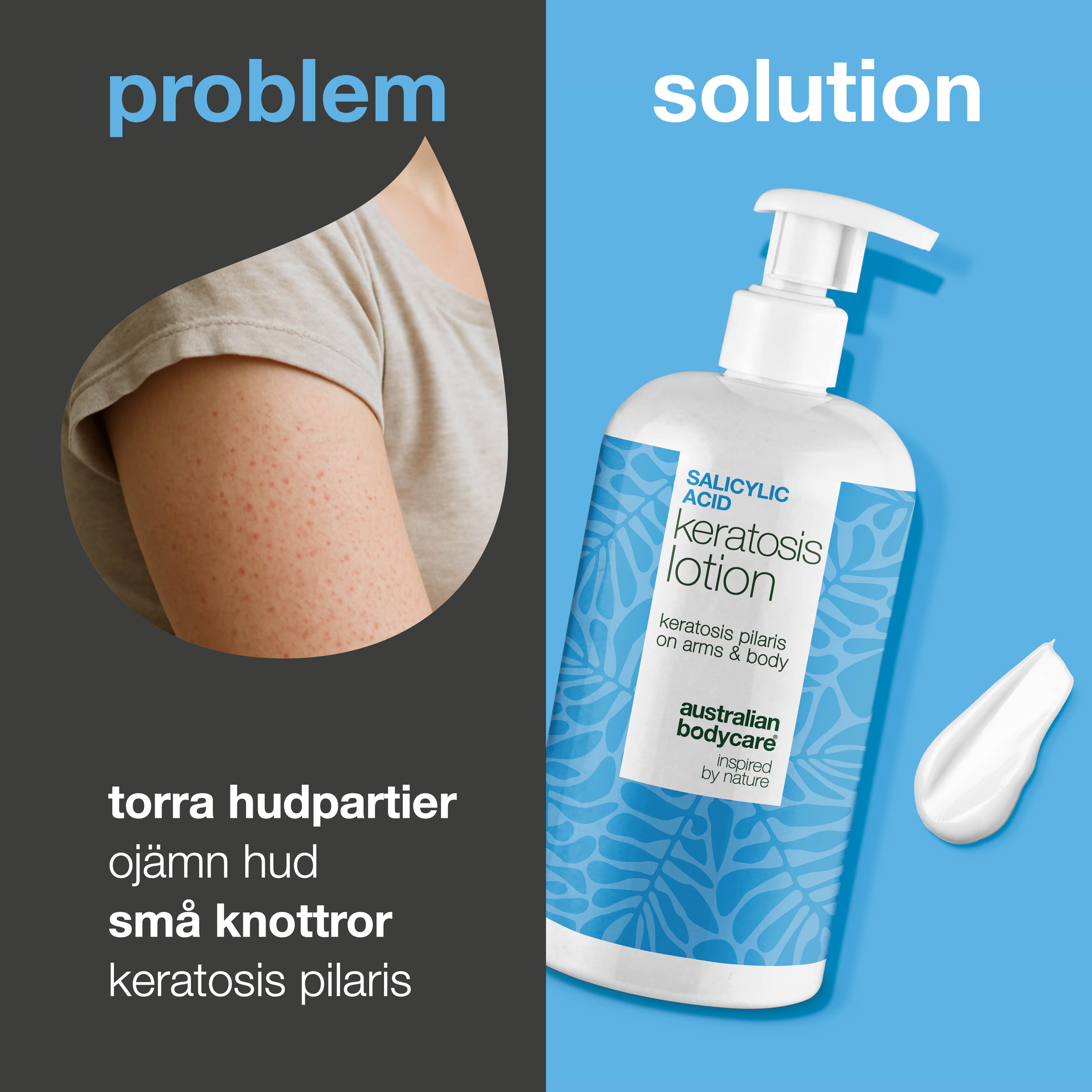 Australian Bodycare Salicylic Acid Keratosis Lotion 500 ml - produktbild 2