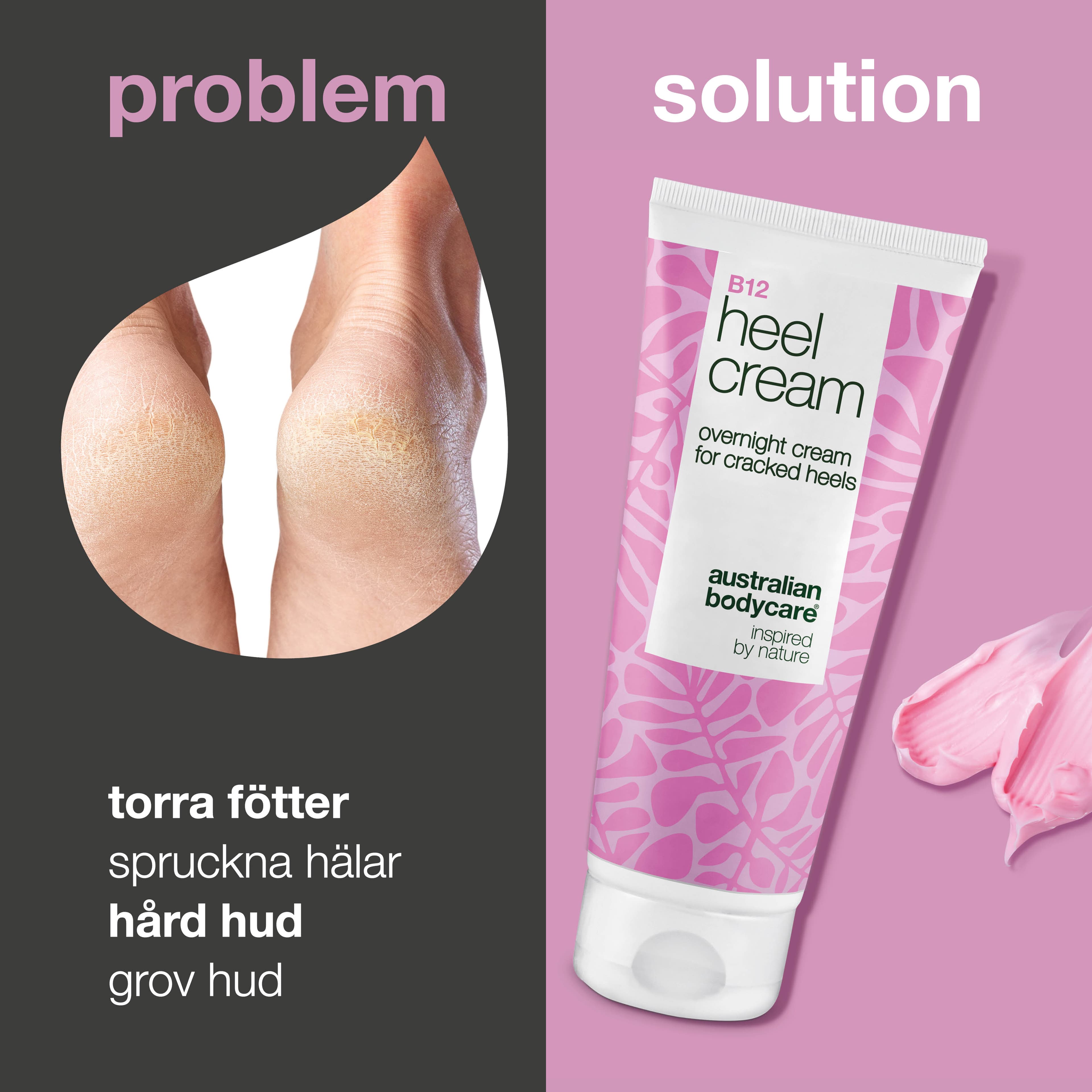 Australian Bodycare B12 Heel Cream 100 ml - produktbild 2