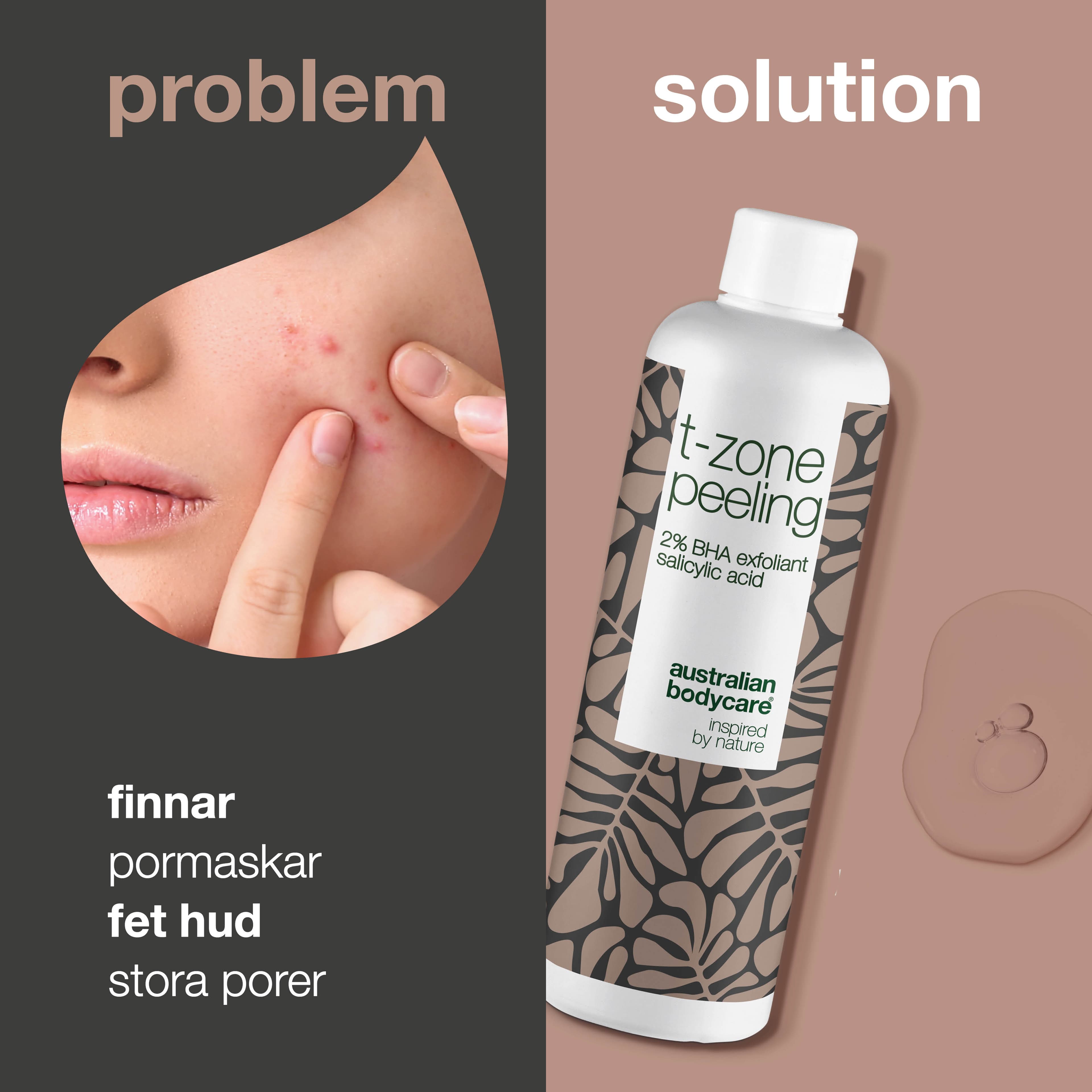 Australian Bodycare T-zone Peeling 150 ml 2