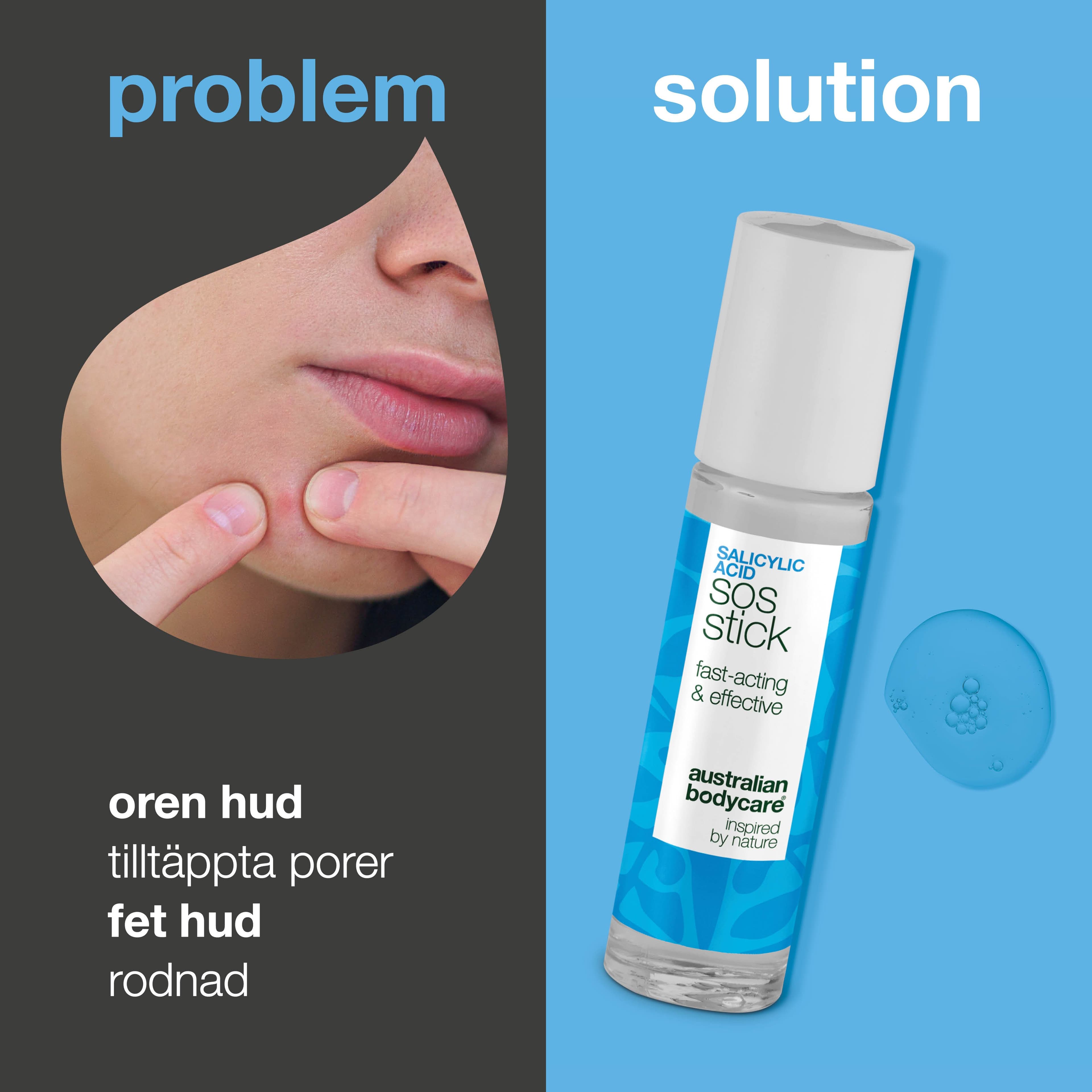 Australian Bodycare Salicylic Acid SOS Stick 9 ml - produktbild 2