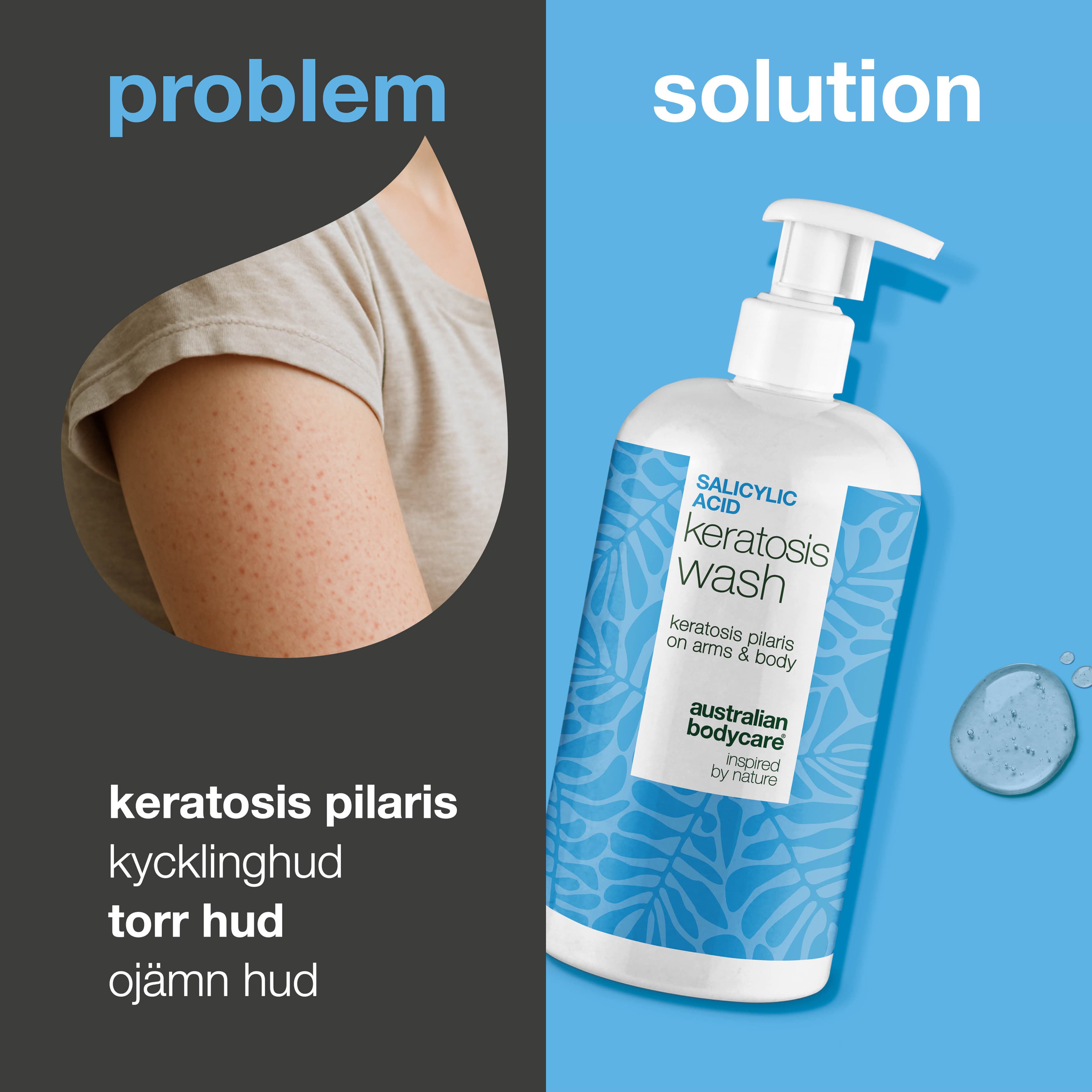 Australian Bodycare Salicylic Acid Keratosis Wash 500 ml 2