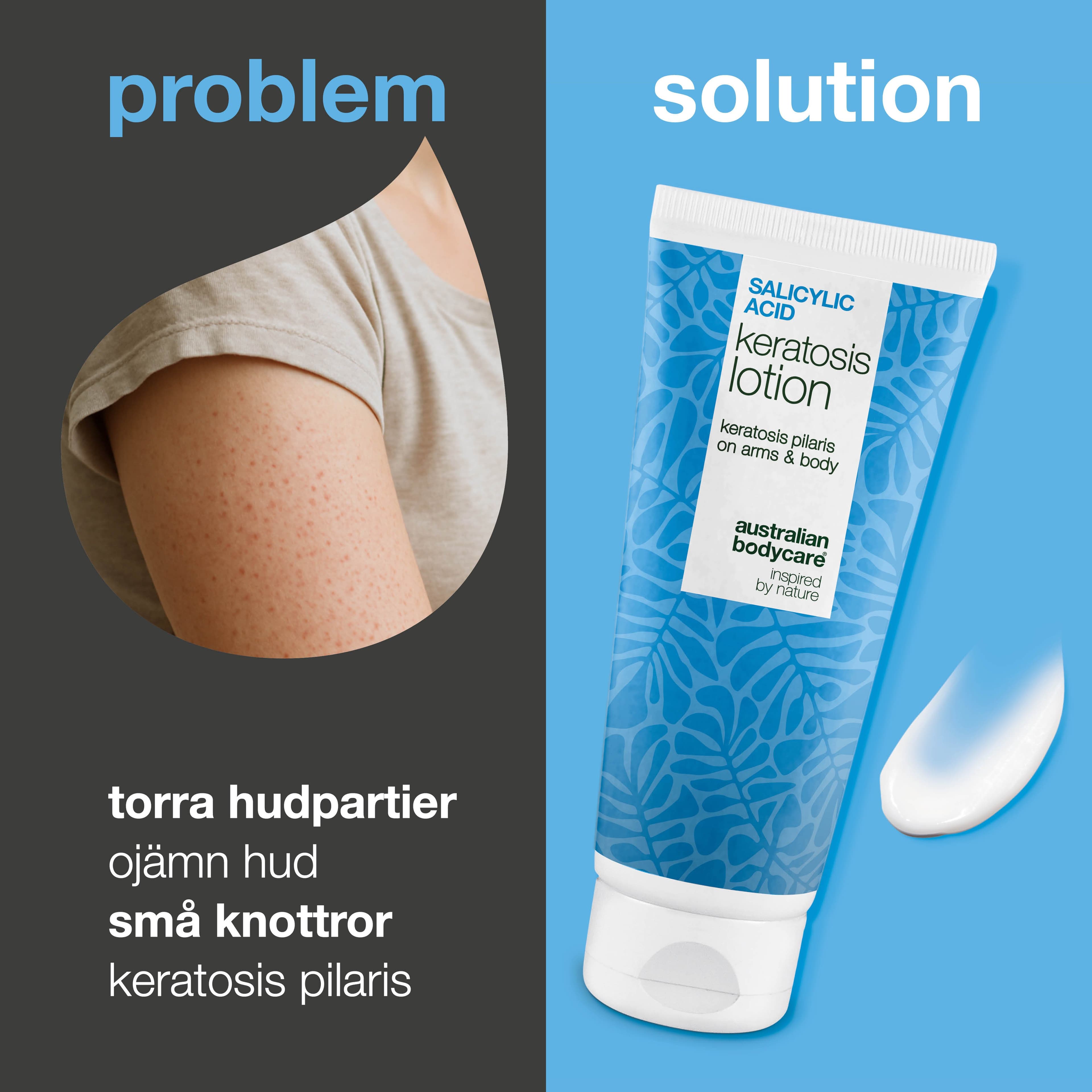 Australian Bodycare Salicylic Acid Keratosis Lotion 200 ml - produktbild 2