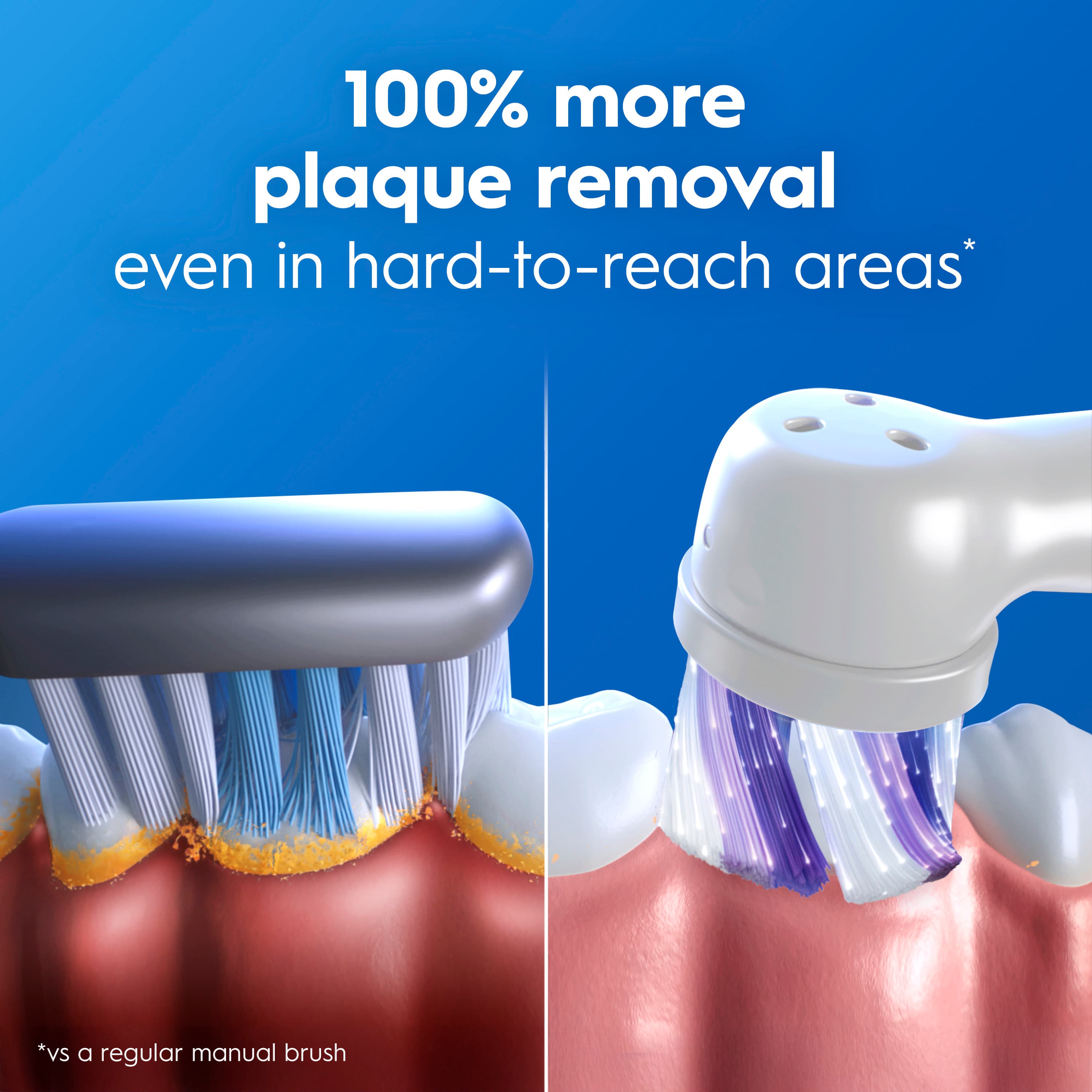 Oral-B iO 2 Calm Pink Eltandborste med Extra Tandborsthuvud & Resefodral - produktbild 2