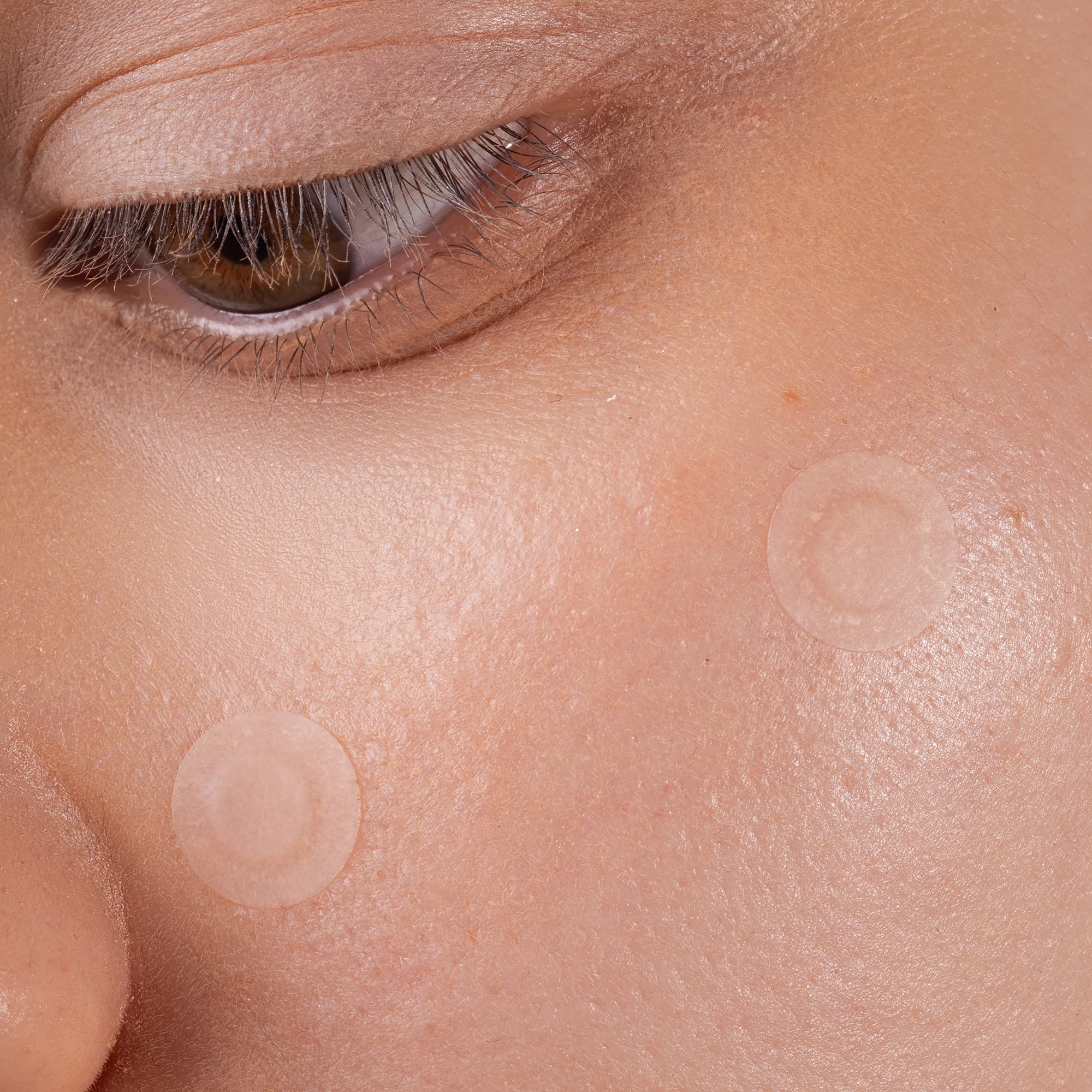 Scandy Spot the F Off Invisible Blemish Patches 24 st 2