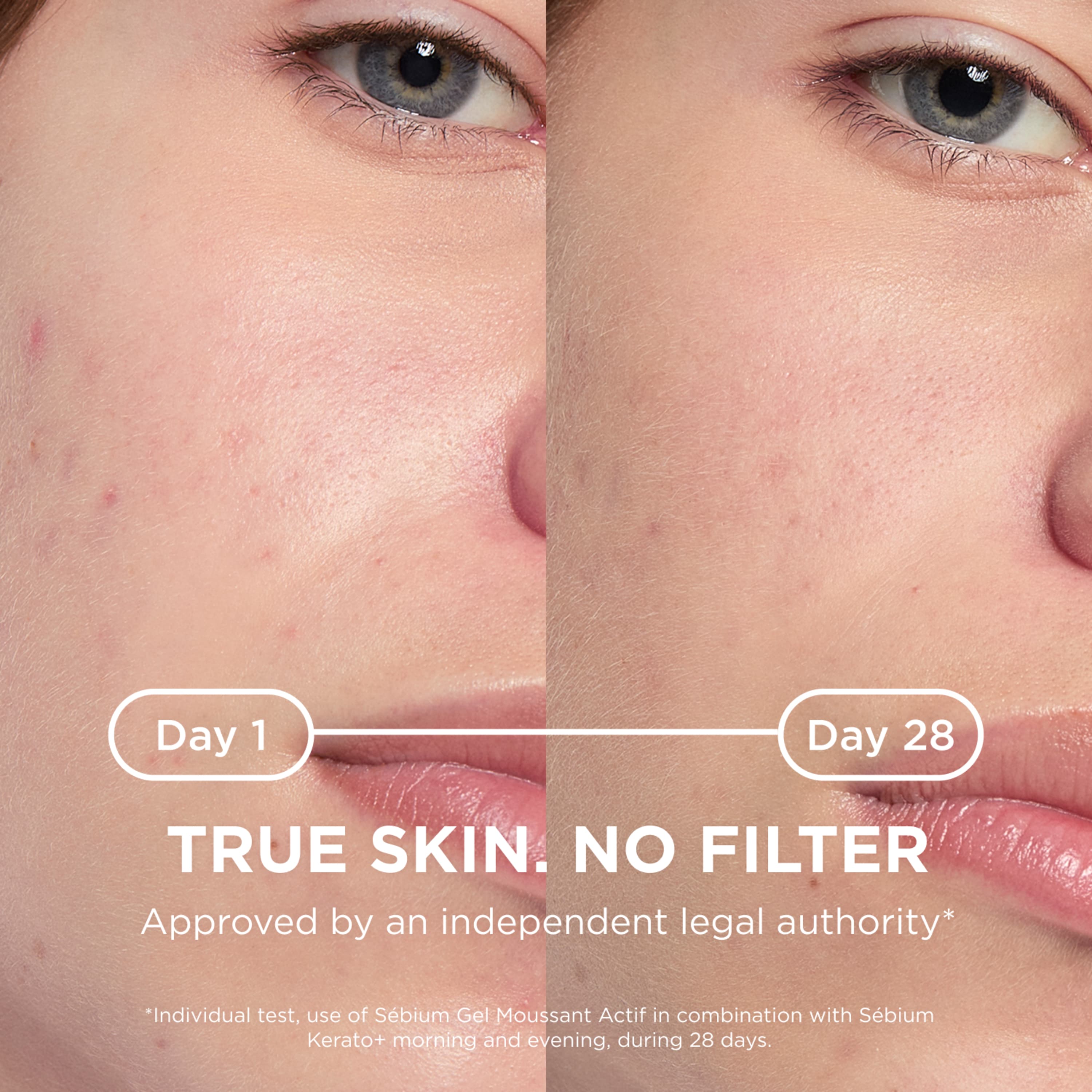 Bioderma Sébium Kerato+ 30 ml - produktbild 5