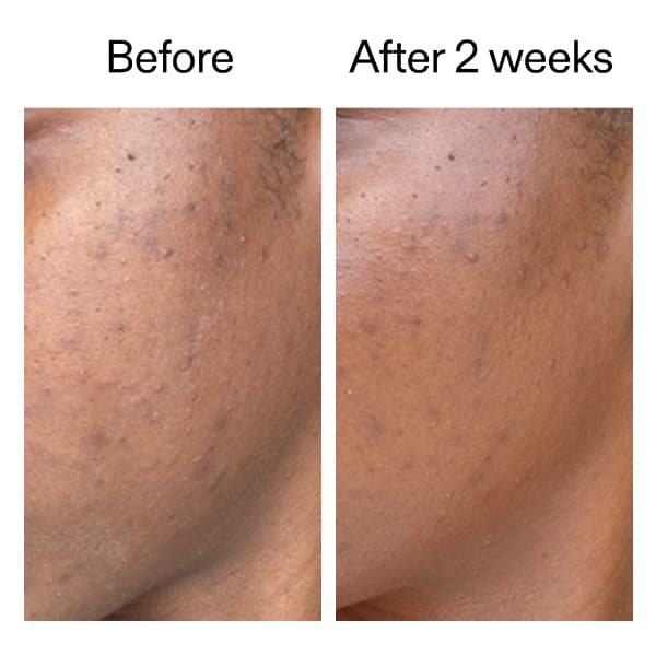 The INKEY List 360 Skin Clearing Serum 30 ml 5