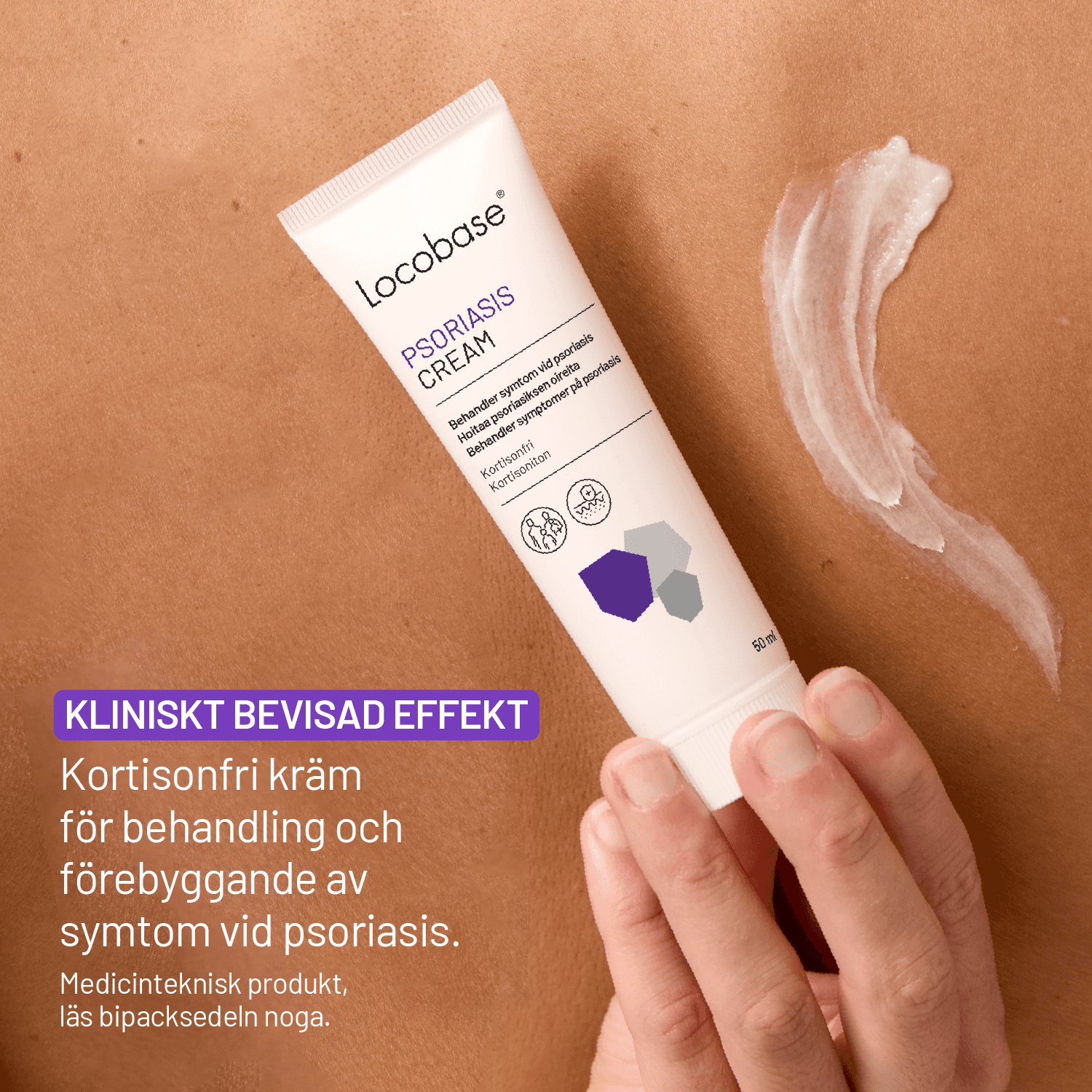 Locobase Psoriasis Cream 50 ml 2