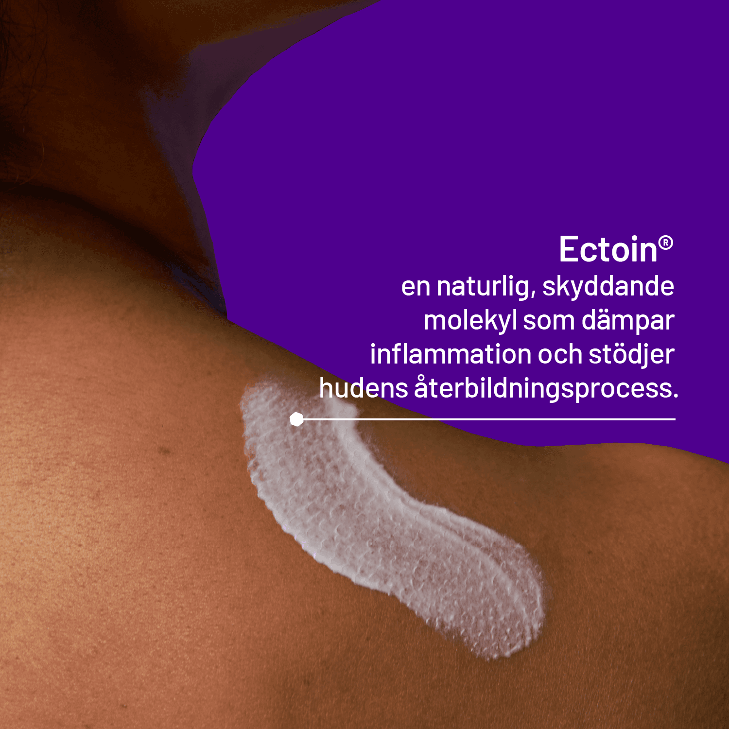 Locobase Psoriasis Cream 50 ml 3