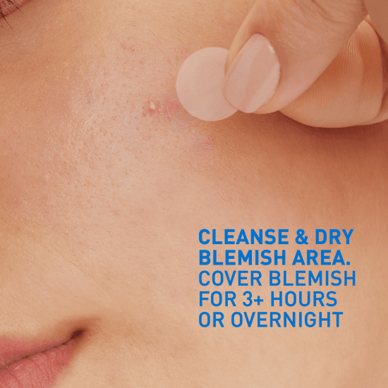 CeraVe Blemish Barrier Patches 22 st 3